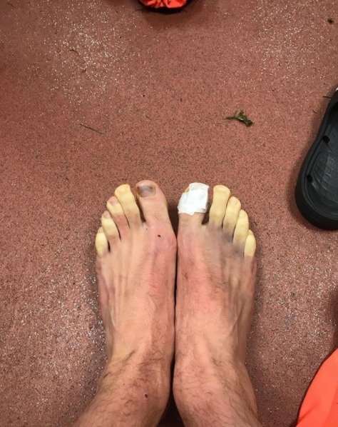 Los pies de Adam Lallana