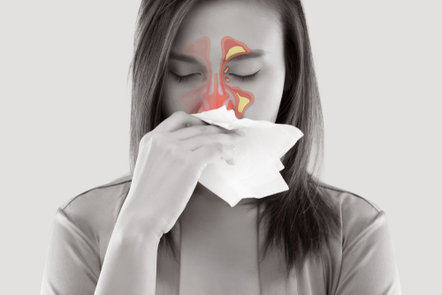 La rinitis alérgica es la alergia más común en el mundo.