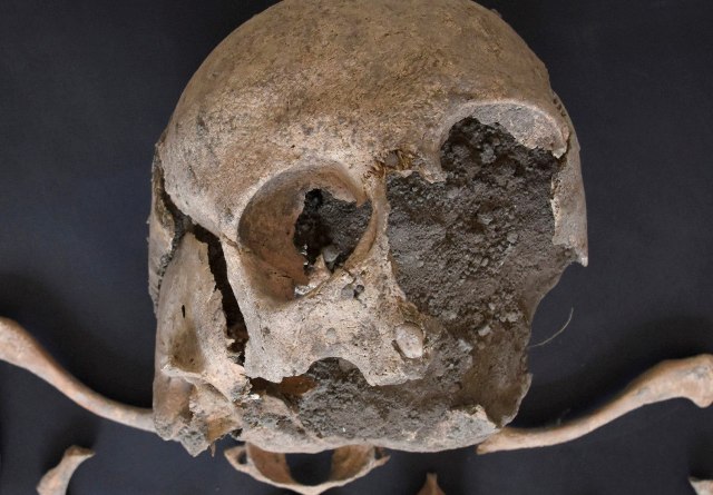 Restos óseos de un infante de entre 7 y 8 años habitante de Pompeya en el 79 d.C.
