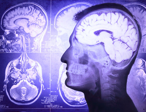 Si sufres de depresión u obesidad, no eres tú: es tu cerebro.