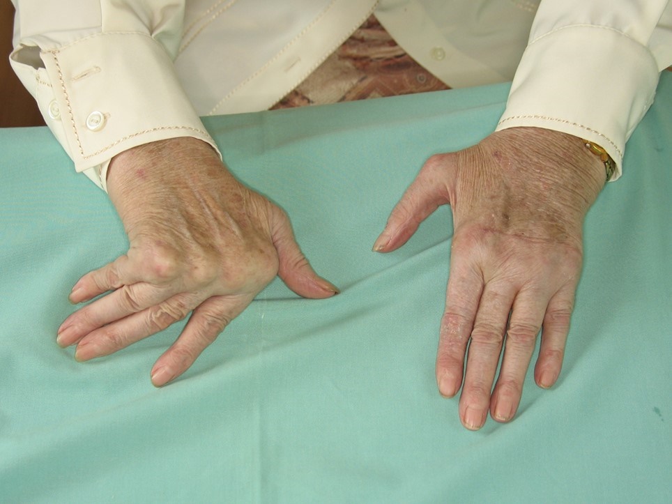 Médicos señalan los beneficios del bicarbonato de sodio.