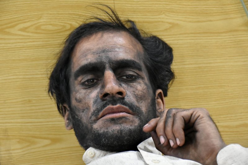 Varias personas resultaron heridas por la explosión y derrumbe en Baluchistán, Pakistán. (Reuters)