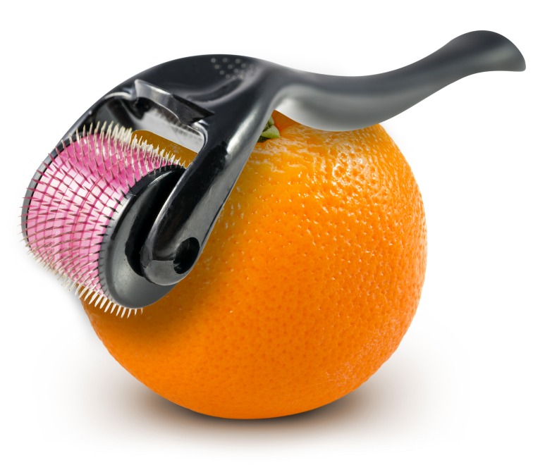 Para prevenir secuelas estéticas en la maternidad, lo mejor es dar a la piel cuidados básicos desde el inicio del embarazo. (Shutterstock)