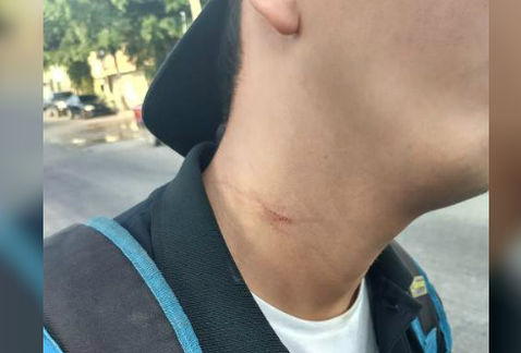 Uno de los repartidores que fue agredido por asaltantes. (Cortesía )