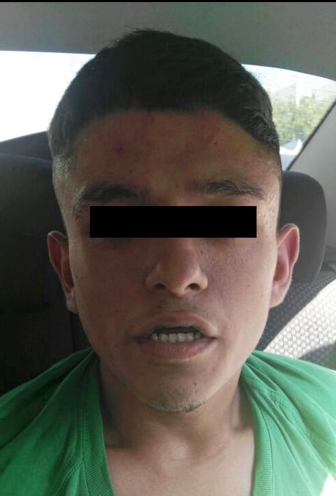 Gerardo le arrojó una piedra en la cabeza.