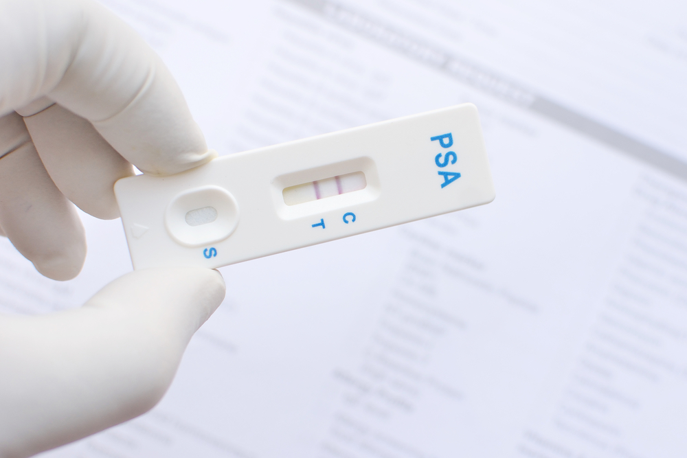 Una, dos o tres líneas indican la presencia del antígeno prostático específico en la sangre. (Shutterstock)