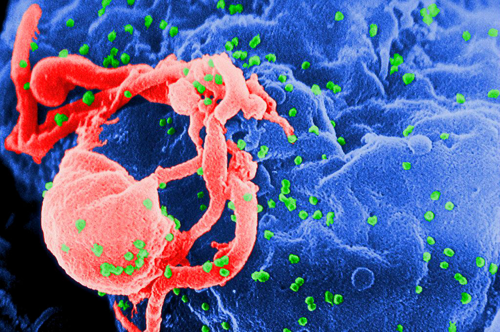 Imagen del virus de inmunodeficiencia humana, causante del sida. (Especial)