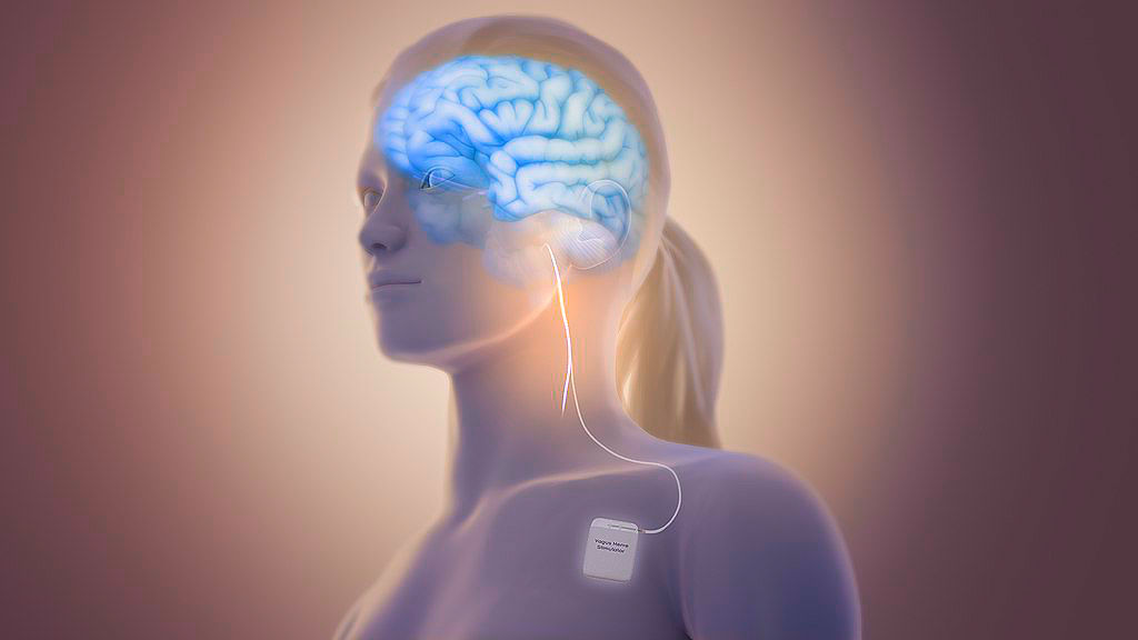 Como en la cinta 'Naranja mecánica', científicos estudian el modo de reducir la violencia desde su origen: el cerebro. (Especial)
