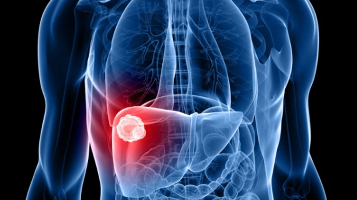 Este año se han diagnosticado en Jalisco 96 casos de hepatitis C.