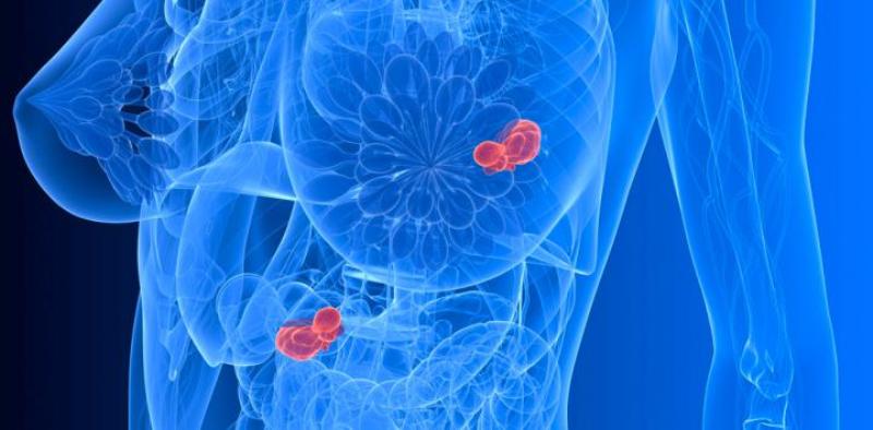 De 2008 a 2025, el número de casos de cáncer en el mundo se incrementará de 7.6 a 11 millones (Especial)