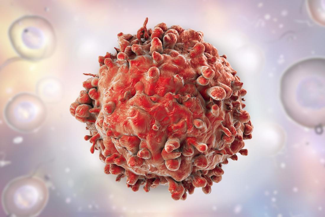 Una célula con leucemia. (Medical News Today)