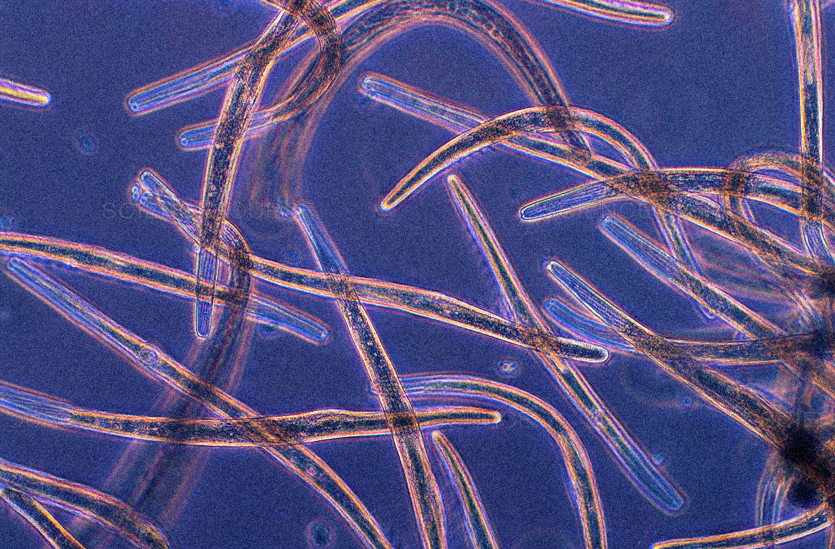 Los 'Spirostomum ambiguum' bajo el microscopio. (Science Source)