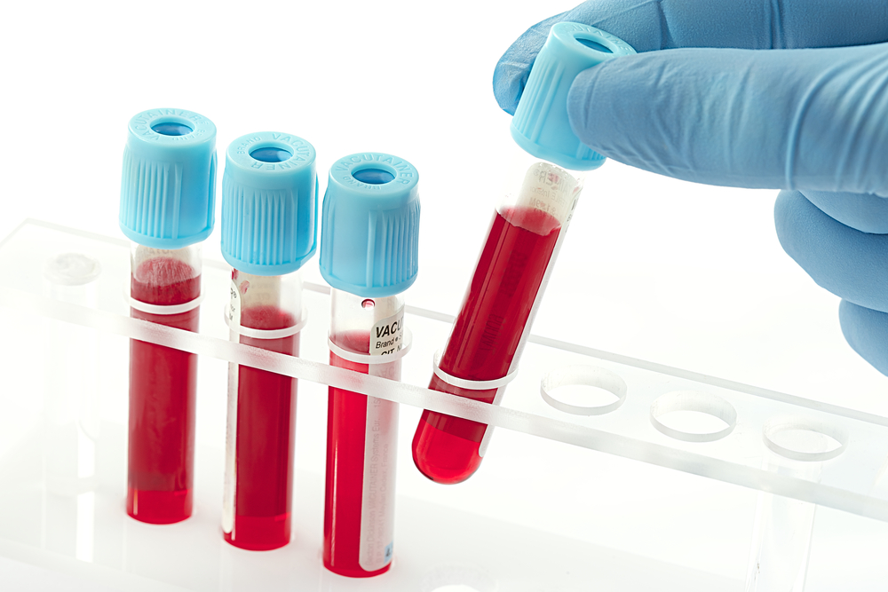 Y tú, ¿conoces tus niveles de colesterol? (Shutterstock)
