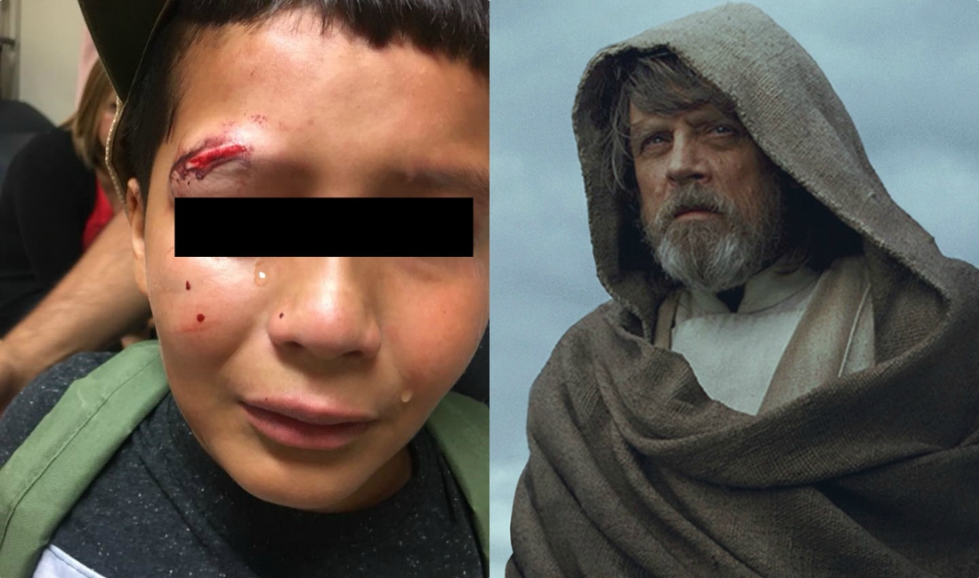 El agresor del niño le provocó una herida de tres pulgadas en la ceja (Especial).