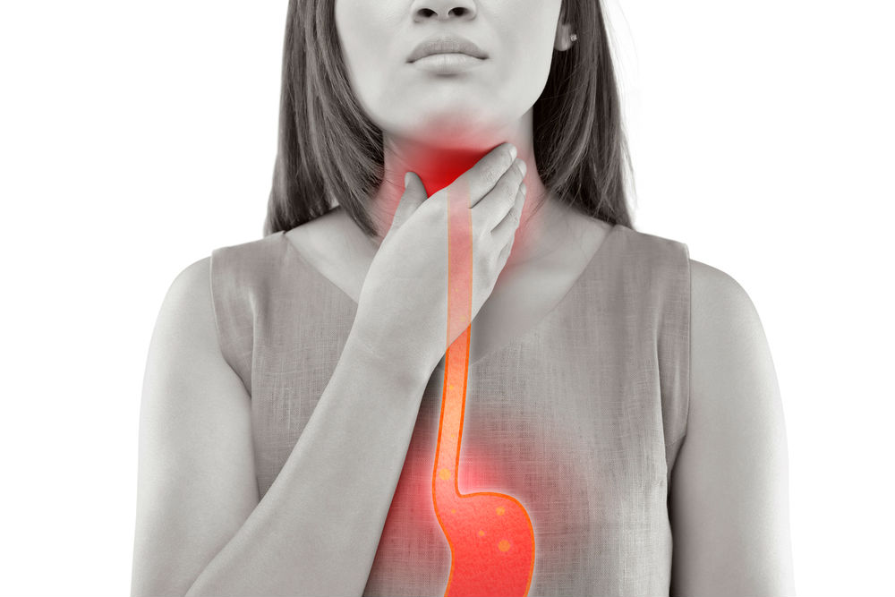 El reflujo gastroesofágico, alarmantemente común en México. (Shutterstock)