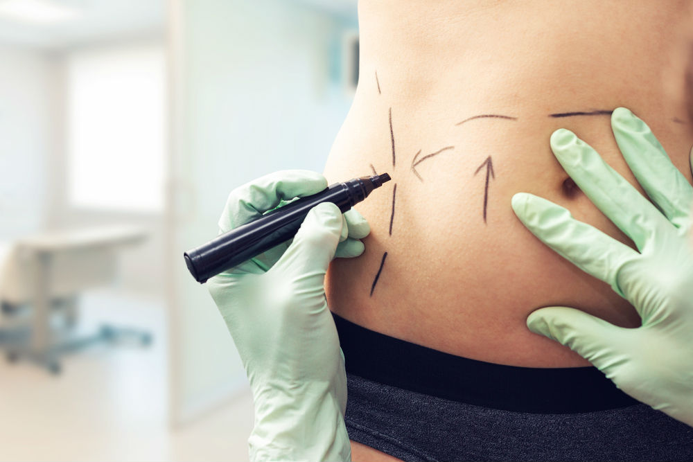 Los procedimientos estéticos deben realizarse por un profesional. (Shutterstock)
