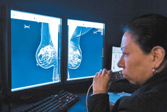 Estudios de neoplasias en los senos.
