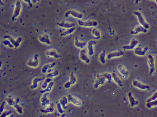 Naegleria fowleri es también conocida como la ameba "come cerebros". (CDC)