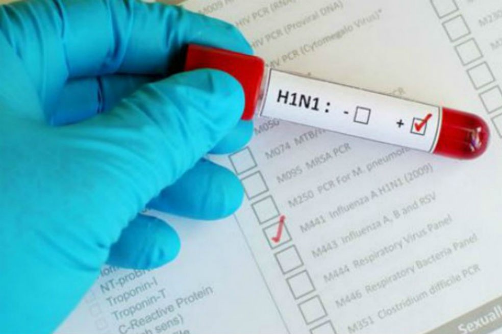 Resultado de caso de influenza