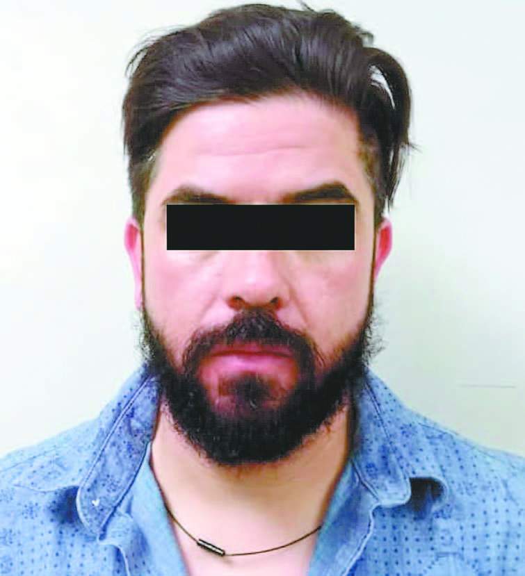 A disposición de un juez de Control y Juicio Oral se encuentra Pedro O., de 37 años de edad. (Foto: Especial)