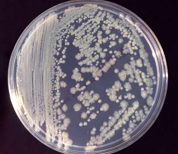 Las bacterias son similares a unas cepas infecciosas halladas en la Tierra. (DPA)