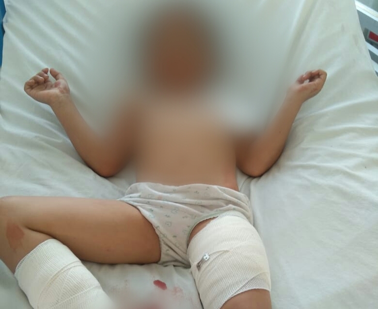 Un menor resultó lesionado durante el ataque. (Jorge Becerril)