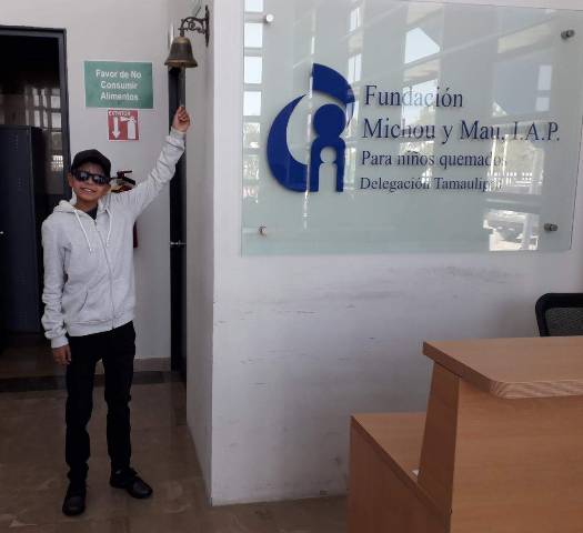 Juanito tendrá que volver a la Fundación Michou y Mau para su valoración, destacó titular a cargo.