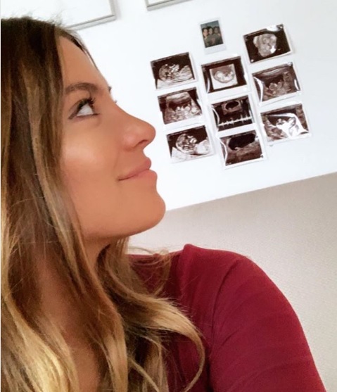 Novia de Javier Chicharito Hernández presume su ultrasonido (@moonstrucktraveller)