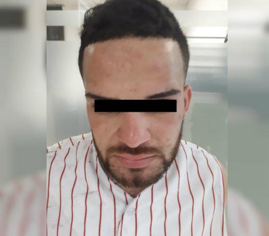 El presunto delincuente fue identificado como Guillermo A., de 22 años. (Especial)