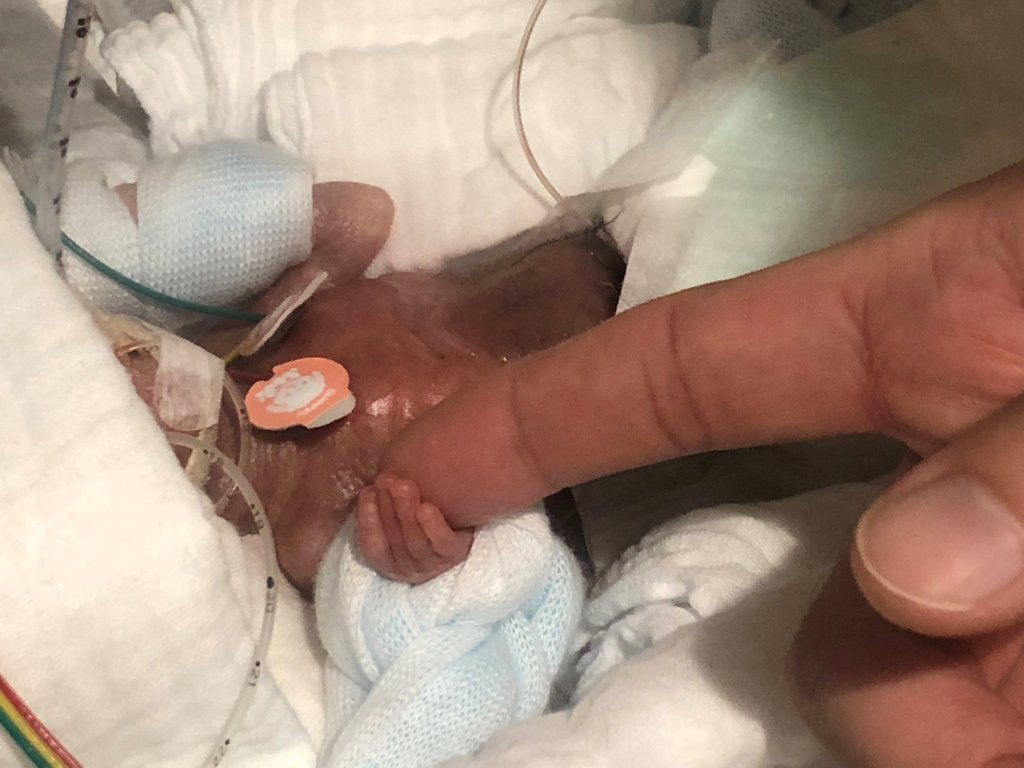 Cuando nació, era tan pequeño que cabía en la mano de un adulto. Reuters