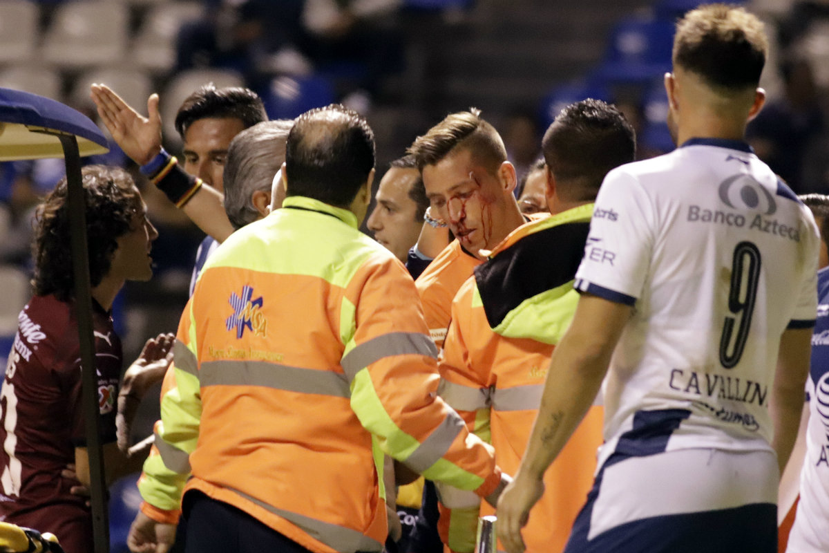 Nicolás Vikonis salió sangrando del Puebla vs Querétaro (Imago7)