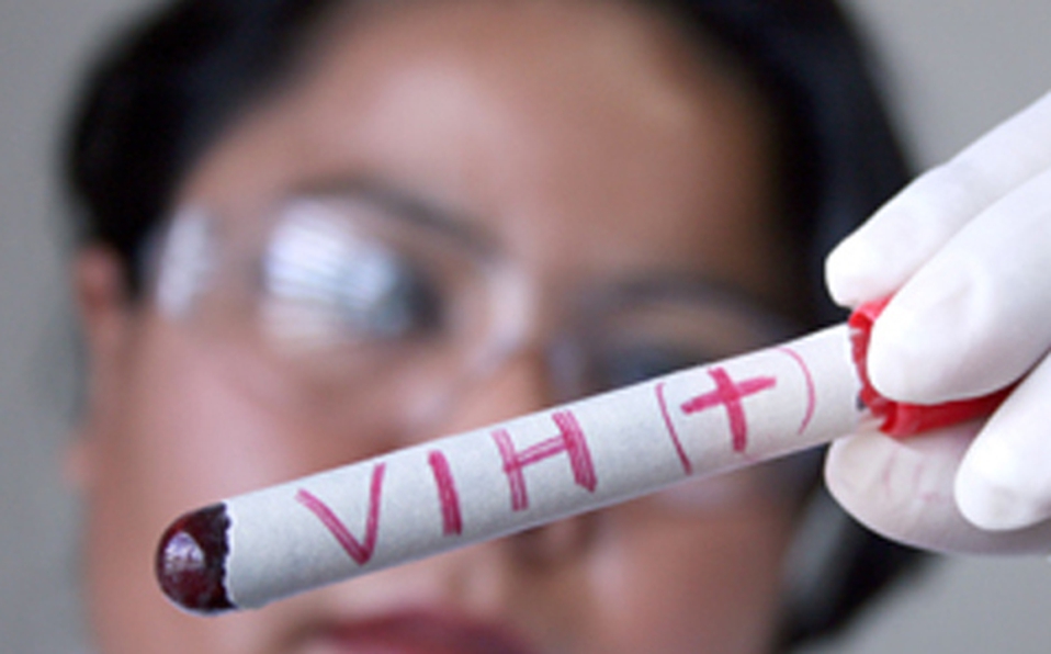 Al igual que con el cáncer, la quimioterapia puede ser efectiva contra el VIH, ya que mata las células que se están dividiendo. Archivo