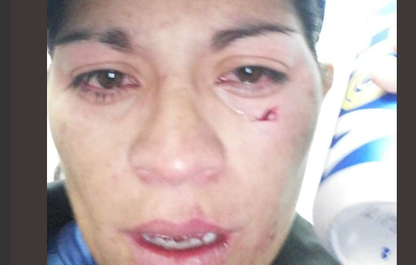 La agresión ocurrió la semana pasada (Especial)