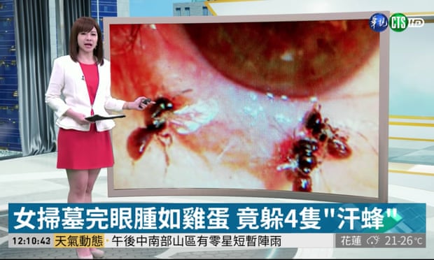 Los doctores retiraron vivas a las abejas. (CTS Taiwán)