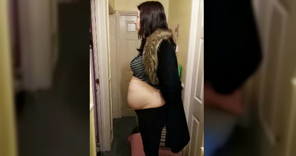 Creyó que estaba embarazada y se trataba de un gran quiste ovárico (The Mirror)