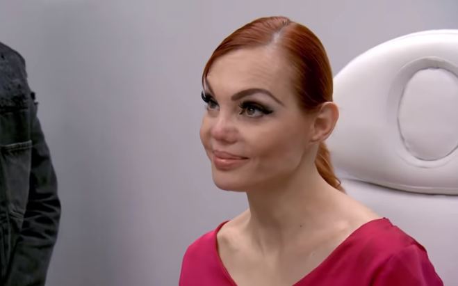 Carmen Campuzano no encontró solución a su problema en 'Botched' (Captura de pantalla de YouTube).