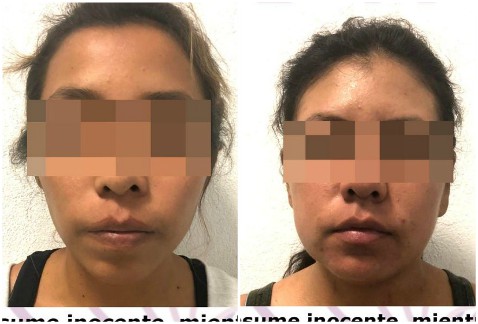 Las dos mujeres fueron detenidas ayer. (FGE Morelos)