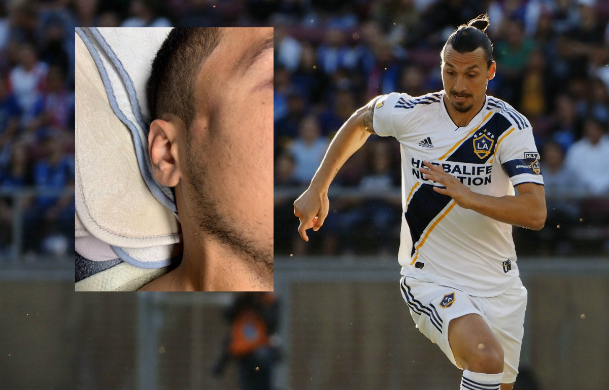 Zlatan Ibrahimovic fracturó a un jugador del LAFC (Reuters / Especial)