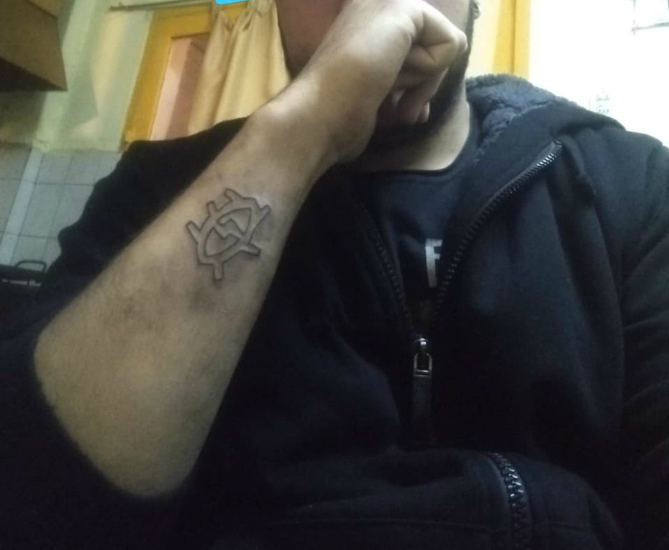 Una semana después de hacerse este tatuaje, el joven se lo quitó con un rallador de queso.