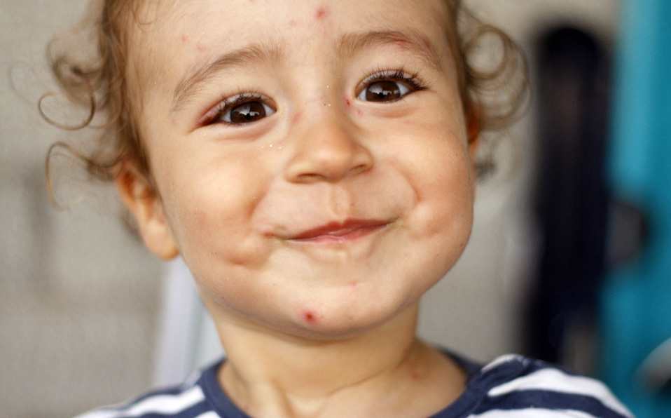 Se recomienda vacunar a los niños para prevenir el virus de la varicela al año de nacidos. (Flickr)