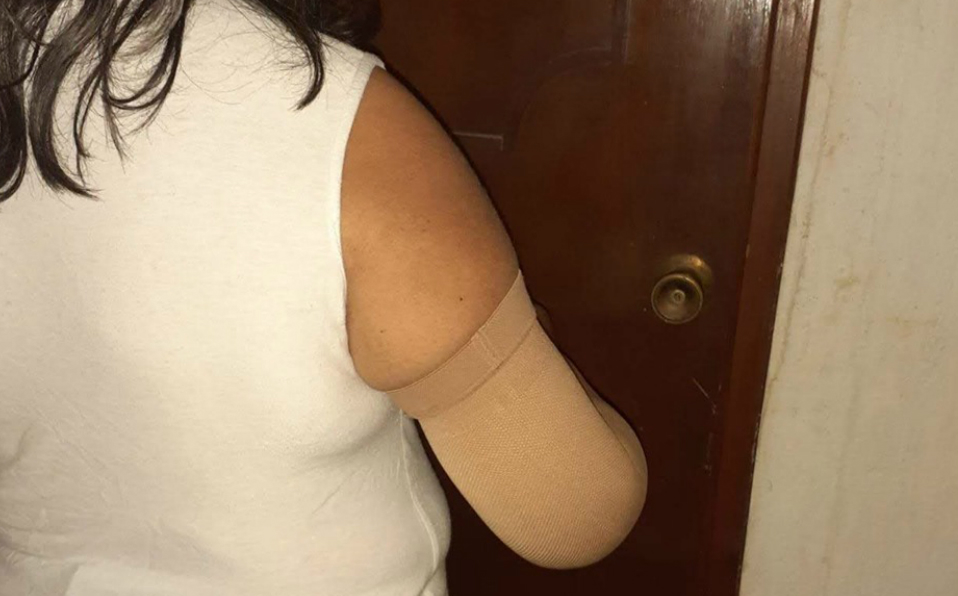 Mujeres con cáncer mamario y su lucha para vencer la enfermedad (Foto/CORTESÍA)