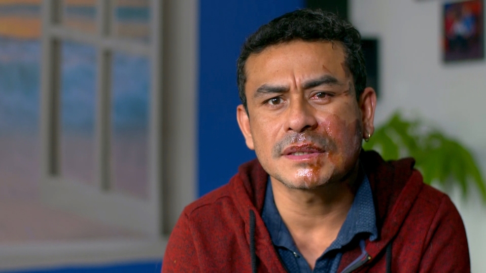 Mahud Villalaz, migrante de origen peruano, sufrió ataque racista (NBC News).