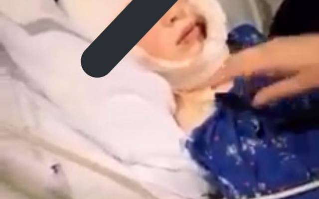 El menor se recupera tras ser intervenido quirúrgicamente.
