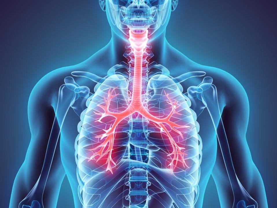 Qué es la Enfermedad Pulmonar Obstructiva Crónica (Shutterstock)