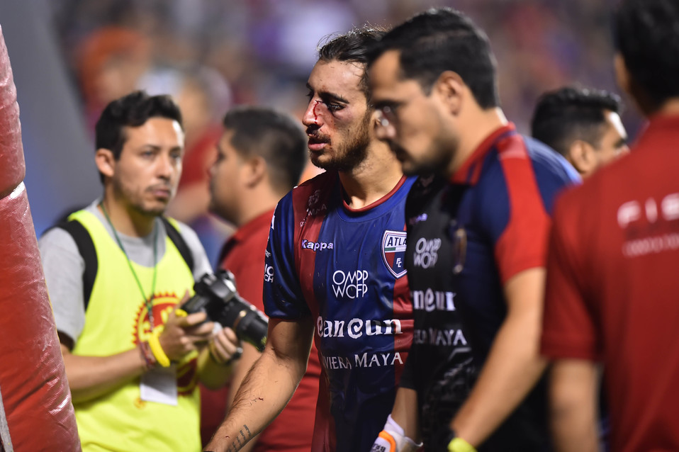 Sebastián Sosa es baja con el Atlante tras golpe ante Zacatepec (Imago 7)
