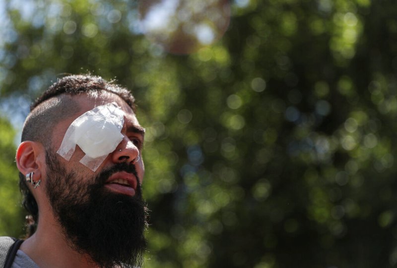 Organismos internacionales han denunciado abusos policiales y graves violaciones a los derechos humanos. (AP)