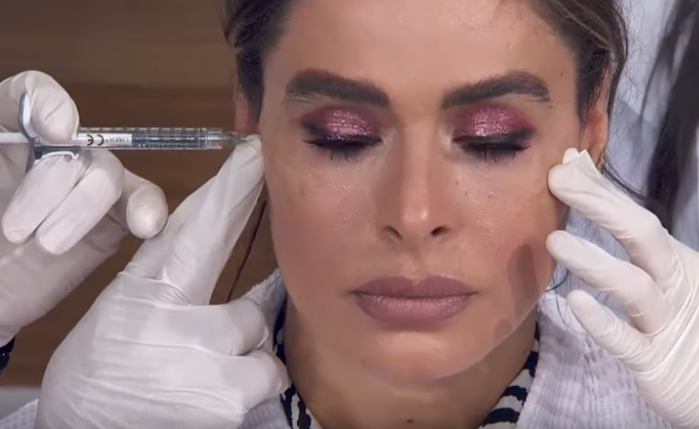 Galilea Montijo se sometió a un procedimiento estético - quirúrgico durante el programa Hoy. (Captura de Pantalla)