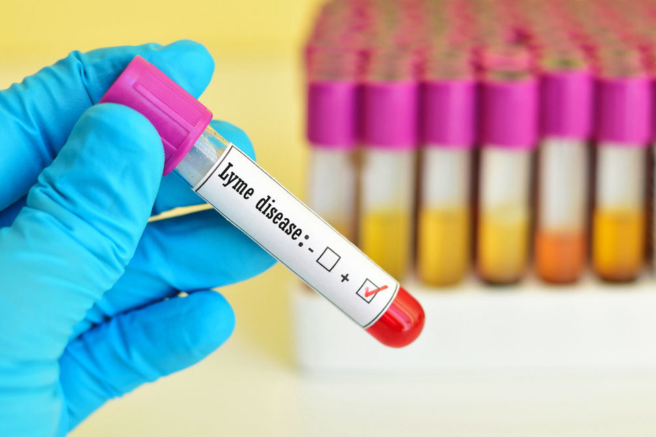 Qué es la enfermedad de Lyme (Shutterstock).