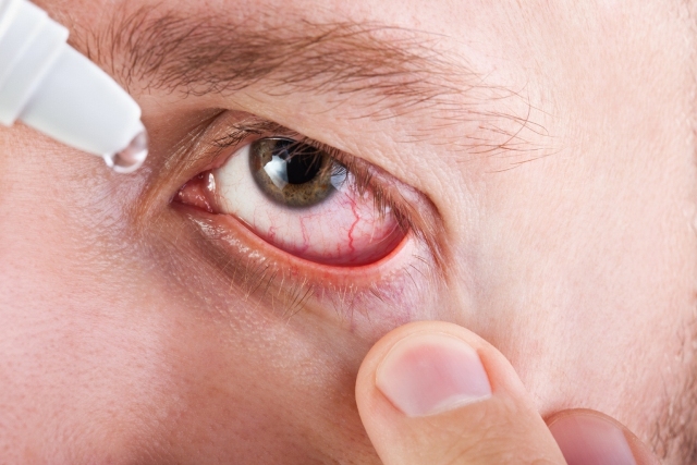 La mujer envenenó a su esposo con gotas para ojos. (Shutterstock)