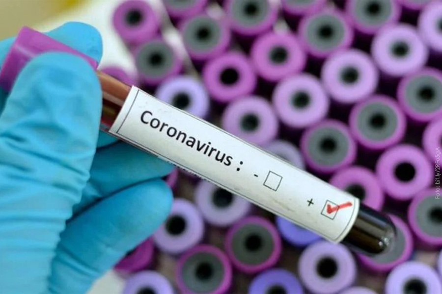 Coronavirus. (Foto: UNAM)